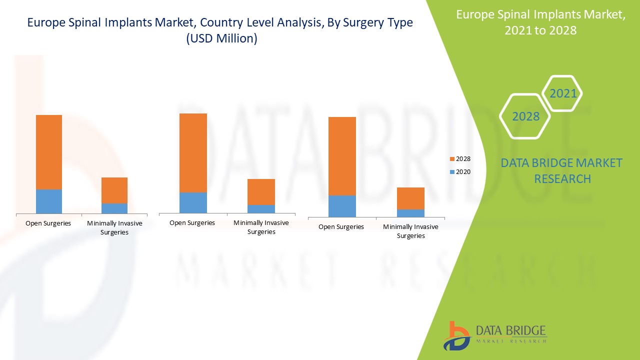 Europe Spinal Implants Market