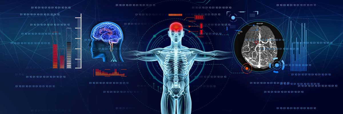 Impact Of COVID 19 On Global Artificial Intelligence In Medical Imaging 