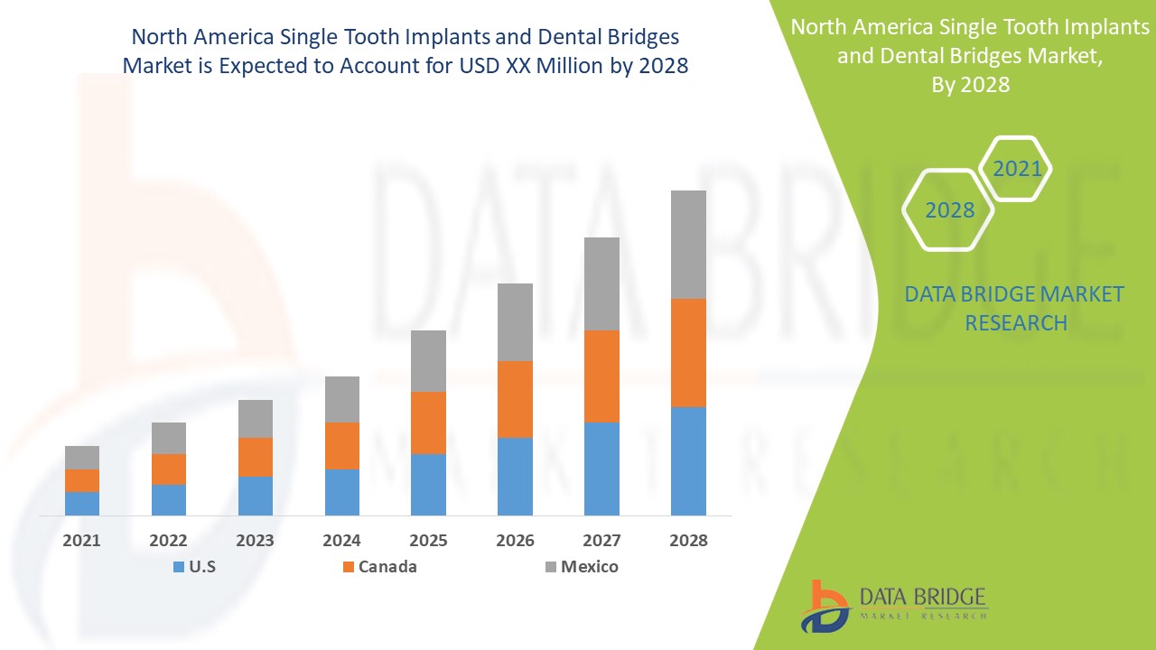 North America Single Tooth Implants and Dental Bridges Market 