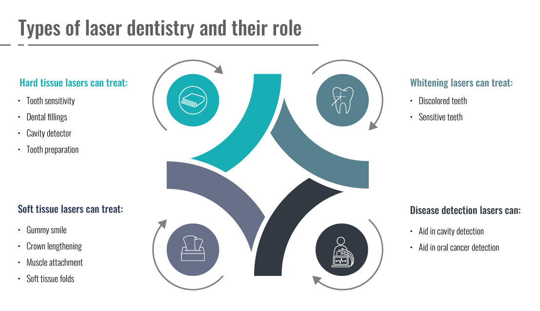 Why is Laser Dentistry the Next New Thing in Odontology