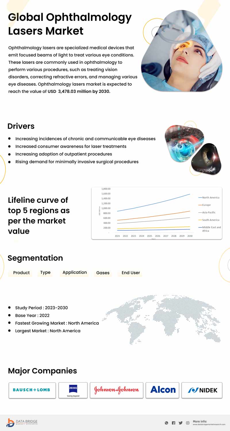 Ophthalmology Lasers Market